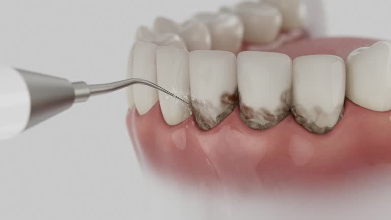 Trusted Teeth Cleaning And Checkup service in Dubuque, IA - Dentist Open Now